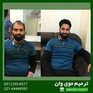 ترمیم مو طبیعی با استفاده از بافت